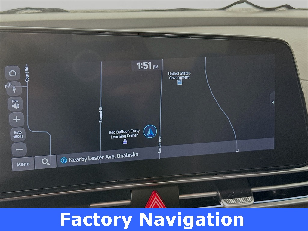 2024 Hyundai Elantra SEL photo 5