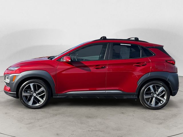 2021 Hyundai Kona Ultimate photo 2