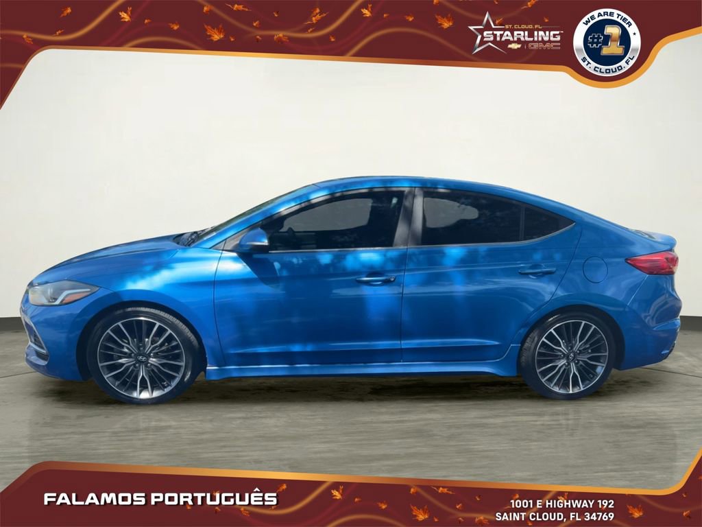 2017 Hyundai Elantra Sport photo 2