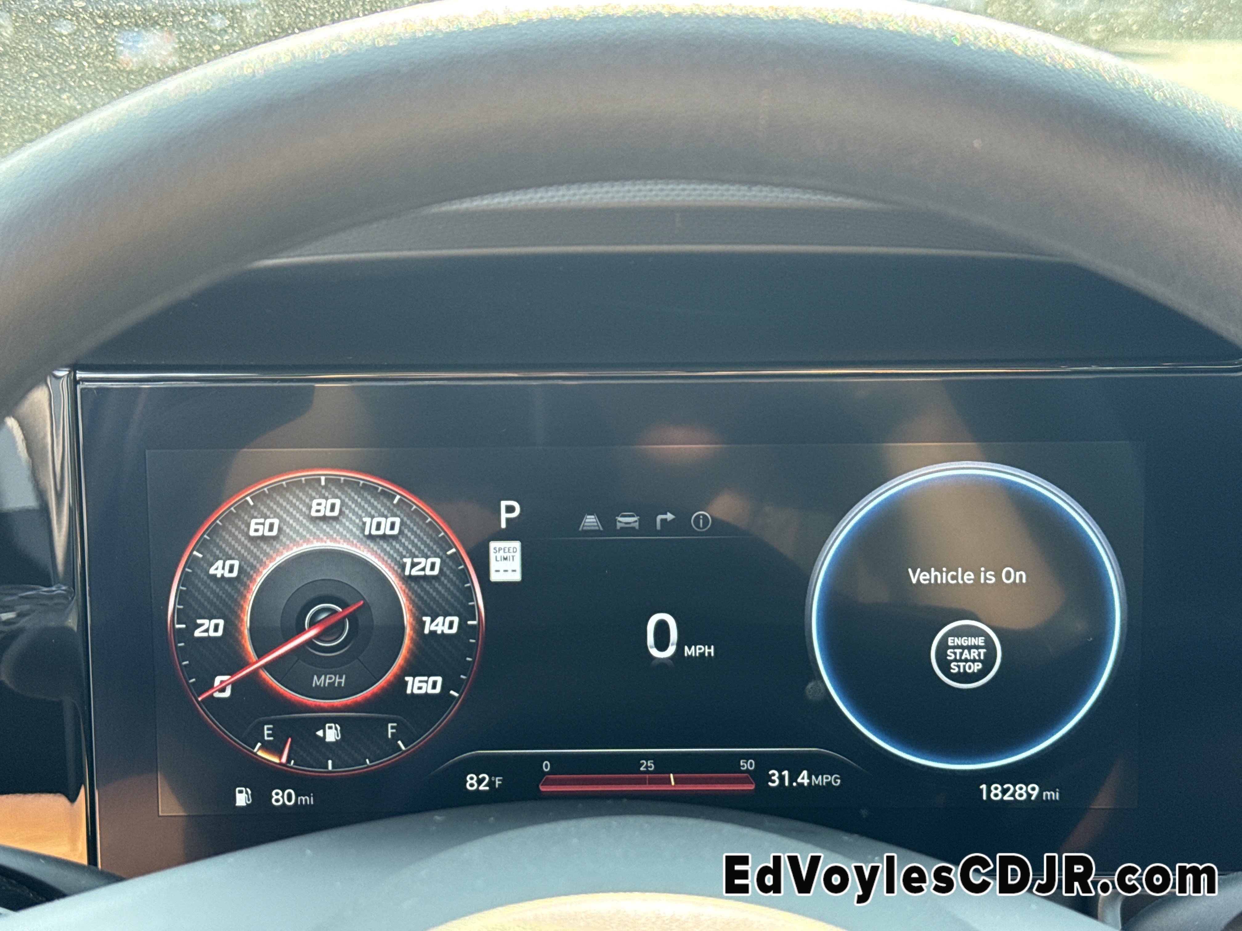 2024 Hyundai Elantra SEL photo 2