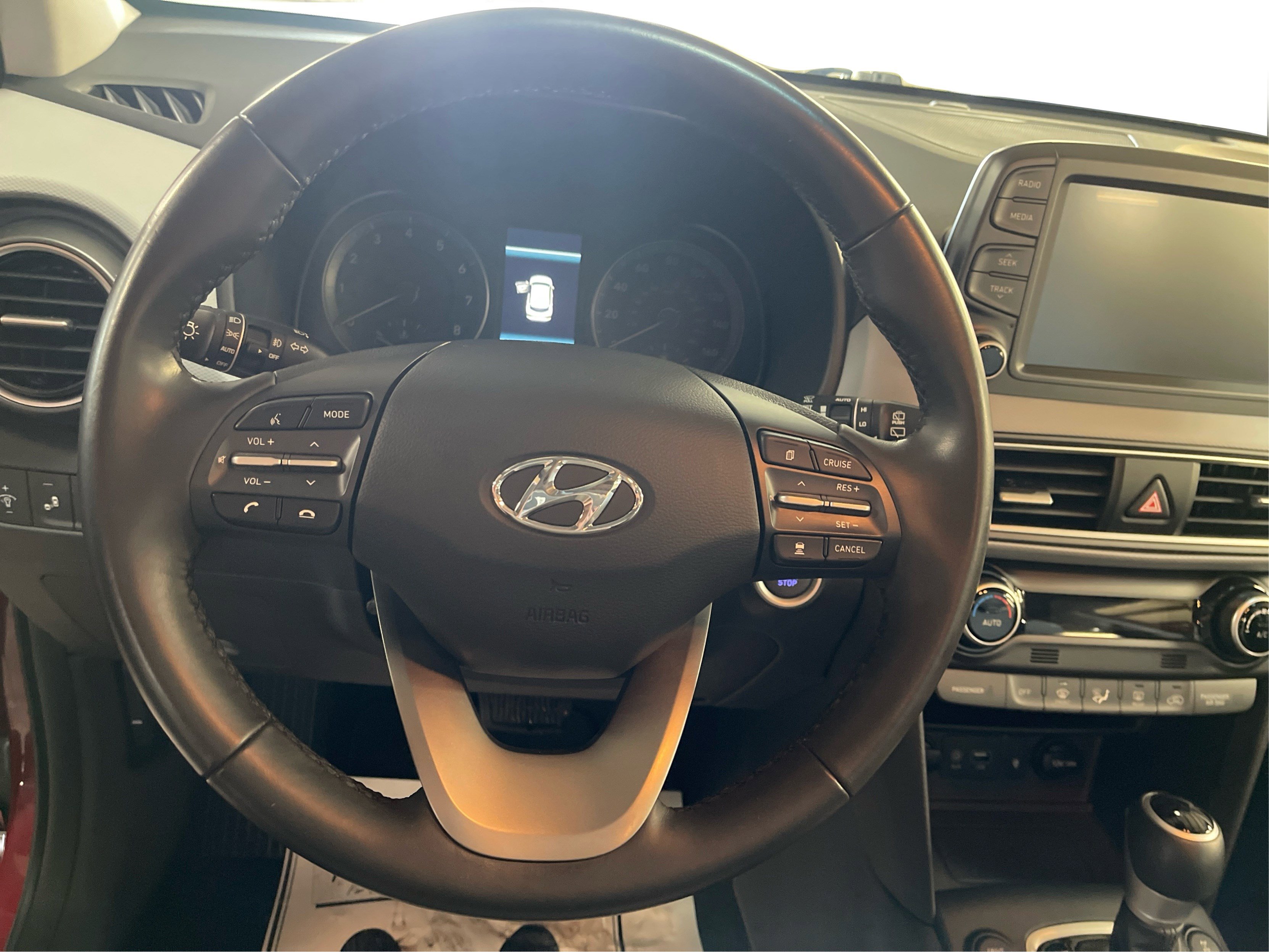 2021 Hyundai Kona Ultimate photo 15
