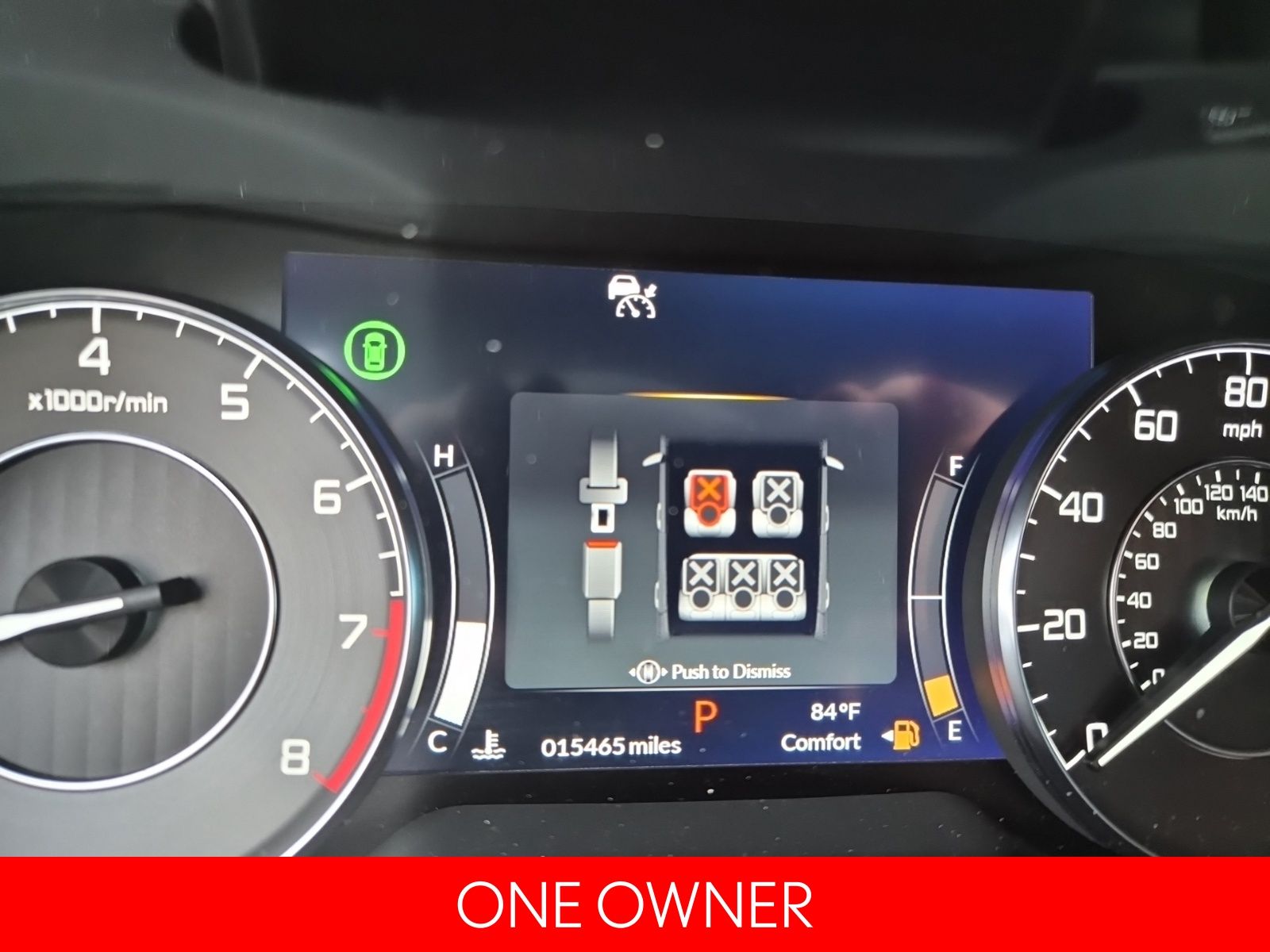 2024 Acura RDX photo 4